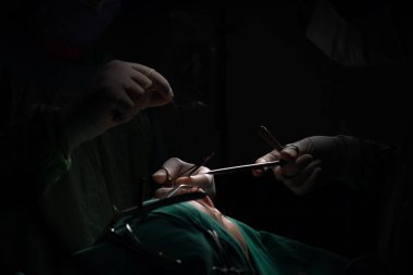 Burun estetiği ameliyatı, kadın hastada burun şeklindeki kusurlar. Estetik cerrahi burun estetiğine cerrahi müdahale