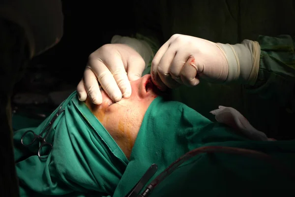 Burun estetiği ameliyatı, kadın hastada burun şeklindeki kusurlar. Estetik cerrahi burun estetiğine cerrahi müdahale