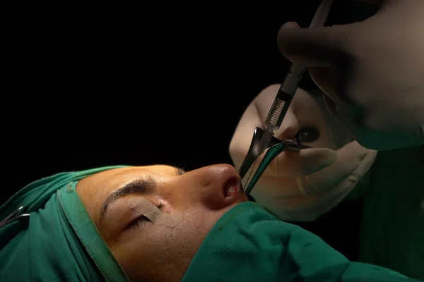 Εγχείρηση Ρινοπλαστικής Ατέλειες Στο Σχήμα Της Μύτης Του Ασθενή Χειρουργική Εικόνα Αρχείου