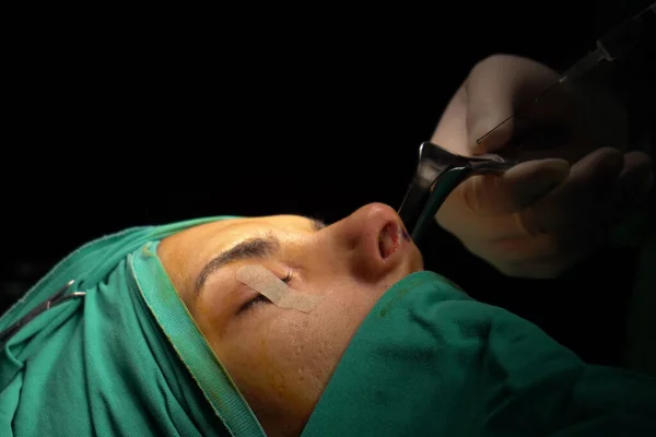Εγχείρηση Ρινοπλαστικής Ατέλειες Στο Σχήμα Της Μύτης Του Ασθενή Χειρουργική Royalty Free Εικόνες Αρχείου