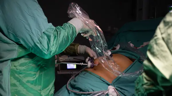 Obezite ameliyatı. Kilo kaybı ameliyatı laparoskopik ameliyatla yapılır. Ameliyathane doktoru ve ekibi ameliyat yapıyor.