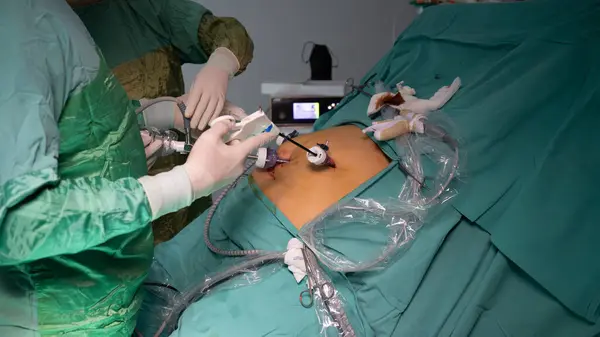 Obezite ameliyatı. Kilo kaybı ameliyatı laparoskopik ameliyatla yapılır. Ameliyathane doktoru ve ekibi ameliyat yapıyor.