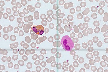 eritrositlerin arka planında çeşitli tipte lökositler vardır.