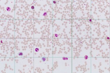 eritrositlerin arka planında çeşitli tipte lökositler vardır.