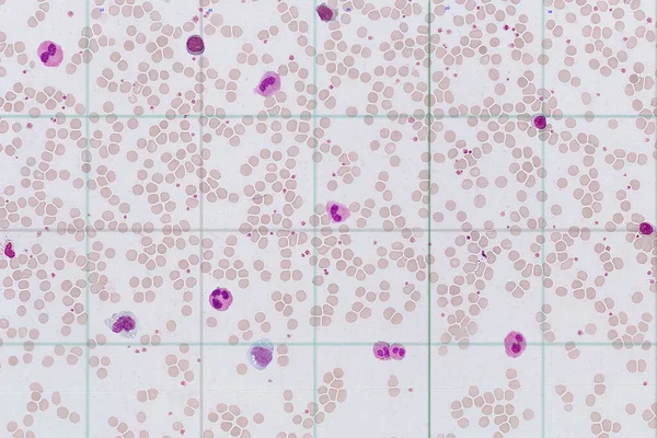 Tegen Achtergrond Van Erytrocyten Zijn Verschillende Soorten Leukocyten — Stockfoto
