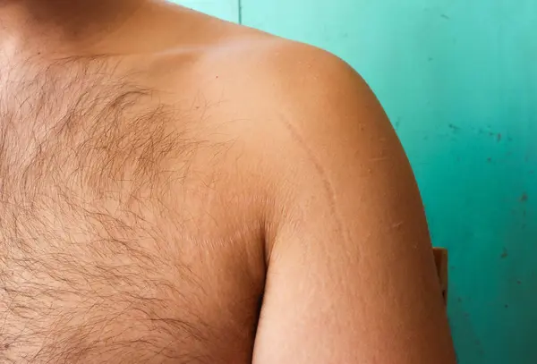 stock image self-acceptance and care as you explore the topic of stretch marks on a man's arms and chest