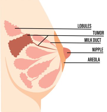 Medical vector diagram of breast with cross-section. Vector illustration clipart