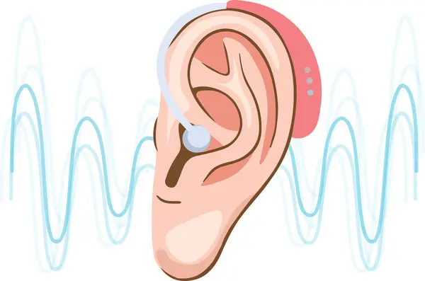  İşitme cihazı olan bir kulak. Vektör illüstrasyonu