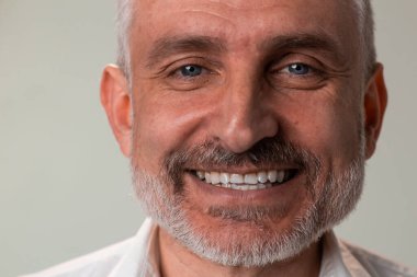 A man with braces on his teeth is beaming for the camera, showcasing his smile and facial hair. His forehead, jaw, ears, and moustache are also visible, portraying a happy expression