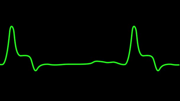 Puls Zelené Barvy Tlukotu Srdce Ekg Monitor Srdeční Tep Kardiogram — Stock video