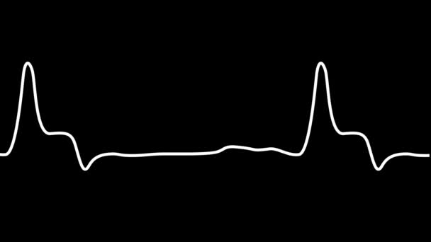 Пульс Серцебиття Білого Кольору Екг Монітор Серцебиття Кардіограми Монітор Серця — стокове відео