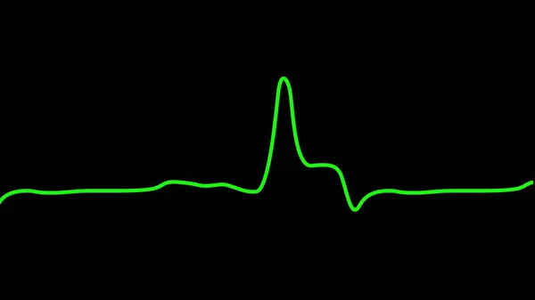Pulso Del Latido Del Corazón Color Verde Monitor Ekg Cardiograma —  Fotos de Stock