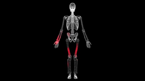 病毒在黑色背景上通过体积骨骼单色传播 病毒在体内的可视化展示 导引影片 医学概念 Fps 3D动画 — 图库视频影像