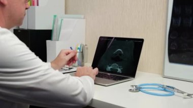 Doktorun iş yeri, hastanın muayenesinin sonuçlarını yorumlayan bir radyologdur. Filmde ve bilgisayarda bilgisayarlı tomografi. Seçici odak.