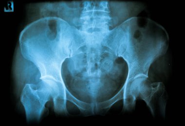 İnsan beyninin röntgeni.