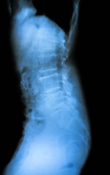 x ray of knee bones and medical spine