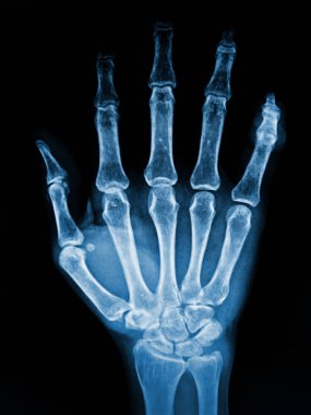 human skeleton bones, x-ray.