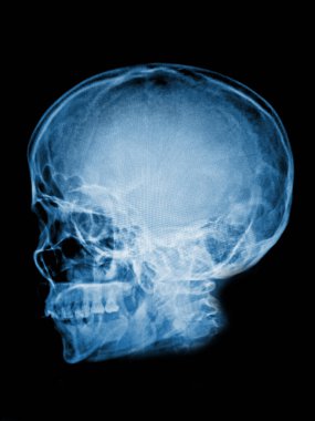 İnsan beyninin x-ray taraması