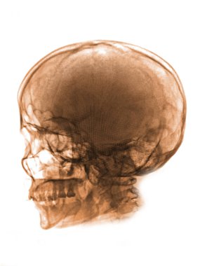 human skull with blood marks