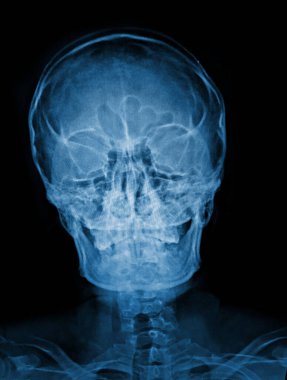 X-Ray görüntü insan beyninin