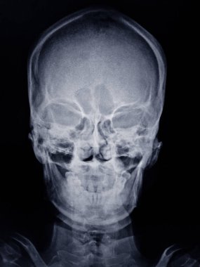 human face anatomy. x-ray.