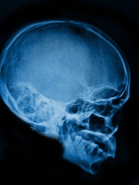 human brain anatomy, x-ray scan