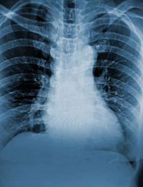 insan omurga röntgeni