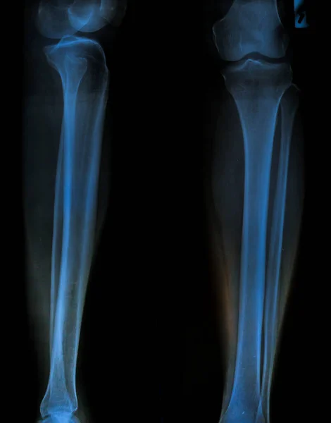 x-ray of human bones