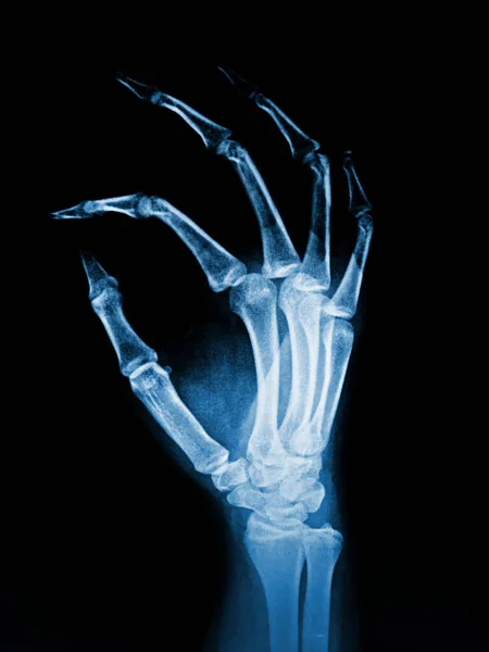 x-ray of human skeleton