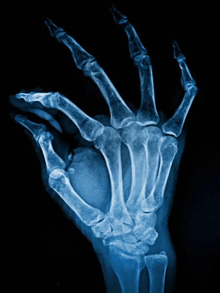x-ray of human skeleton