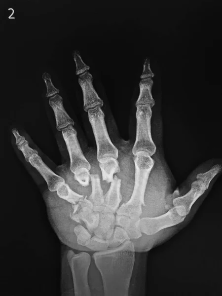 hand holding a x-ray of a human body