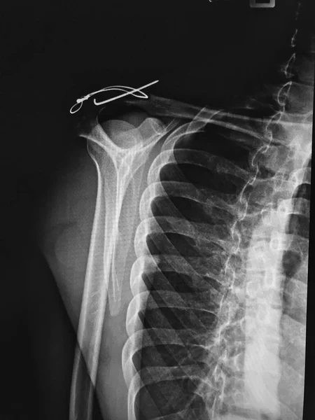 x-ray of human body
