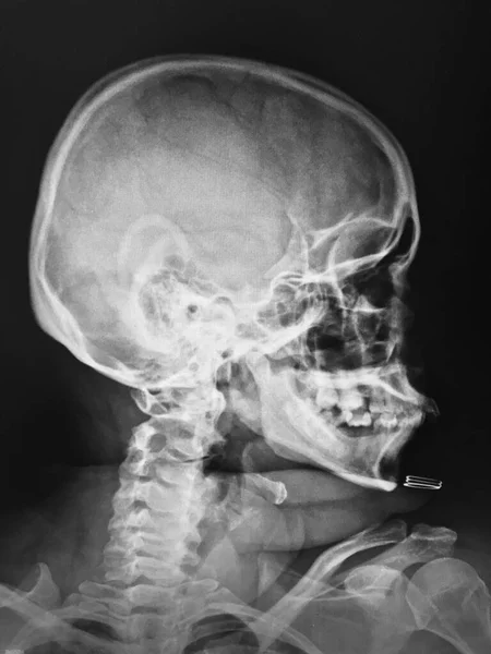 human skull anatomy. x-ray.