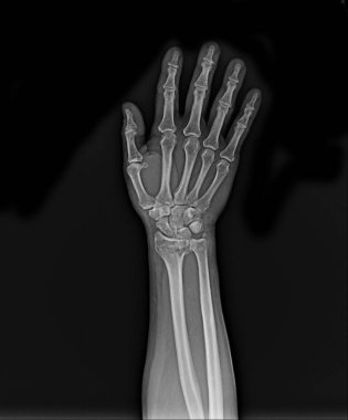 human skeleton bones, 3d illustration