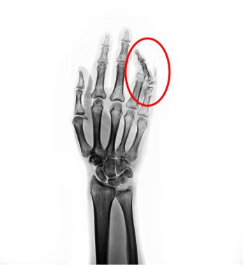 human hand with a stethoscope on white background