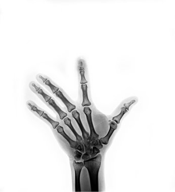 hand drawn medical concept. isolated on white background.