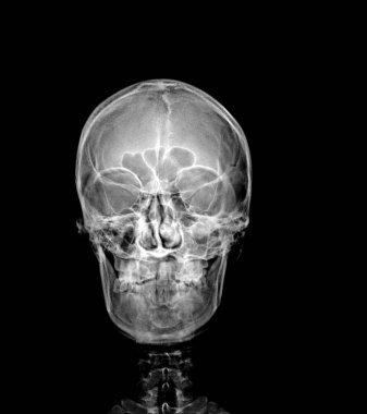 human skull with x-ray on black background