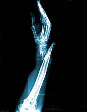 human bones and x-ray image