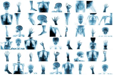 X-ray multiple part of human and many medical condition and disease clipart