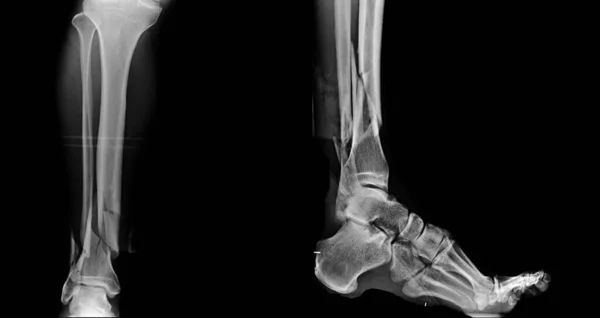 human bones anatomy. x-ray.