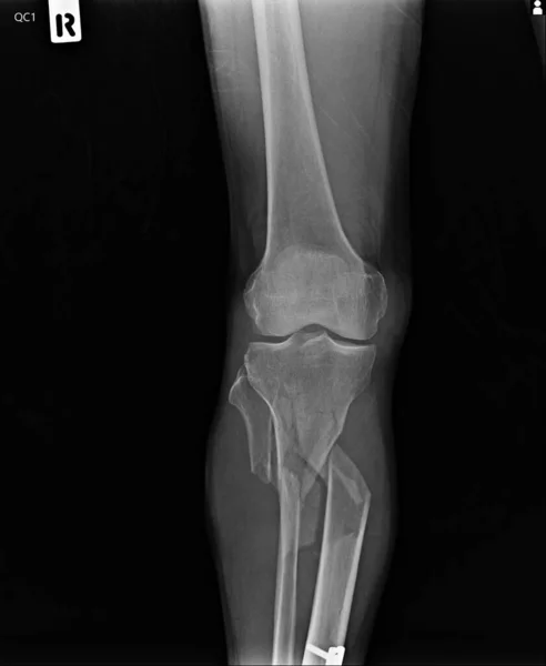 human knee anatomy. x-ray of the spine.
