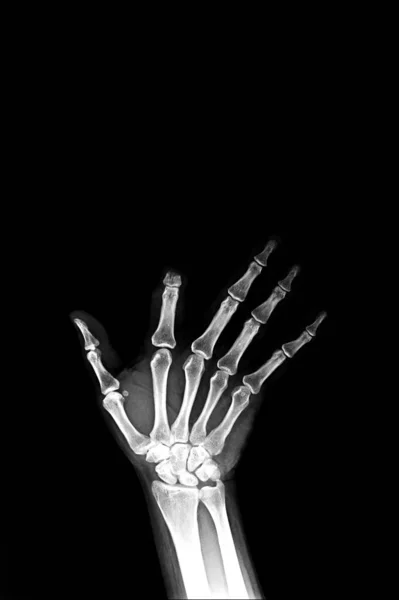hand of human skeleton, joint bone
