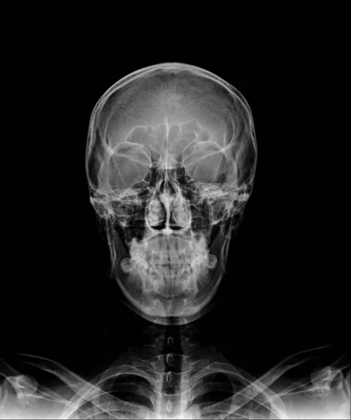 human skeleton x-ray scan