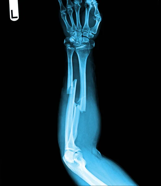 human skeleton anatomy. x-ray.
