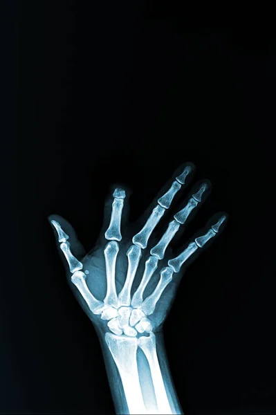 close up of human hand on black background