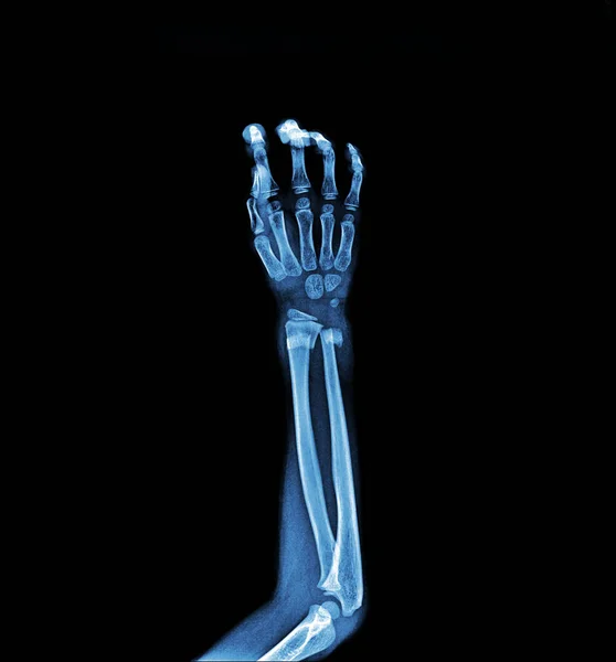 x-ray of human skeleton isolated on black background