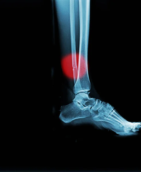 human skeleton knee x-ray of a man