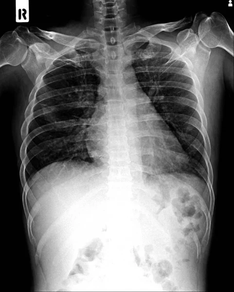 x-ray of human body anatomy