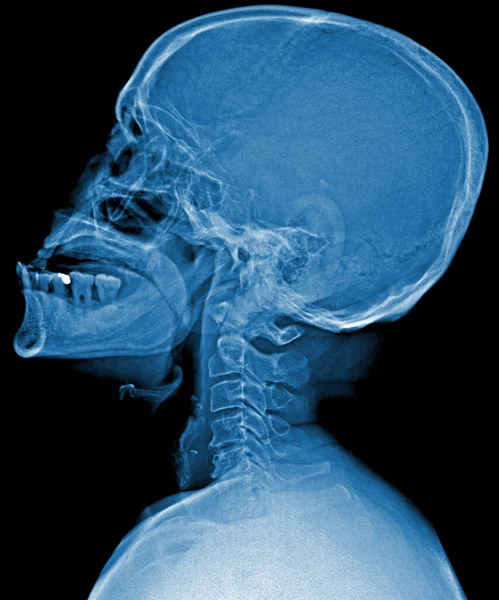 human skeleton anatomy, x-ray scan