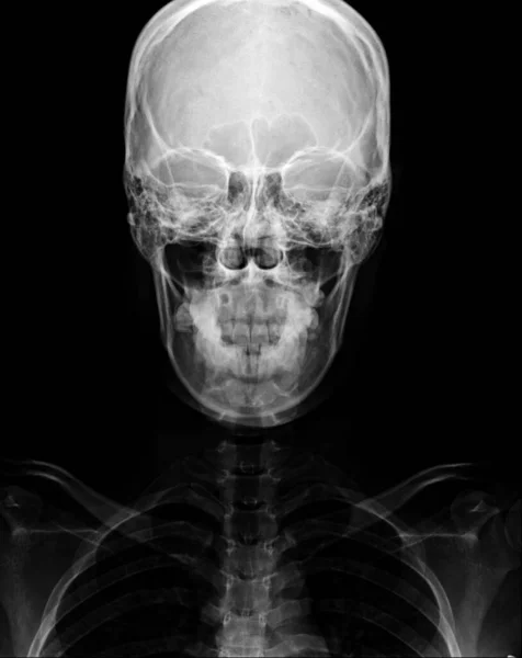 x-ray of human skeleton, side view